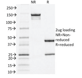ER Alpha / Estrogen Receptor Antibody (clone ESR1/1935)