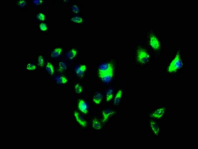 Polyclonal Rabbit anti-Human FLOT1 / Flotillin 1 Antibody (IHC, WB)
