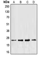 EF1B / EEF1B2 Antibody (Internal)
