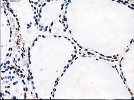 KIAA0153 / TTLL12 Antibody (clone OTI4B2)