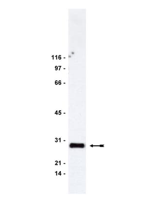 IHC-plus™ Polyclonal Rabbit anti-Human ARHGDIA / RHOGDI Antibody (IHC, WB)