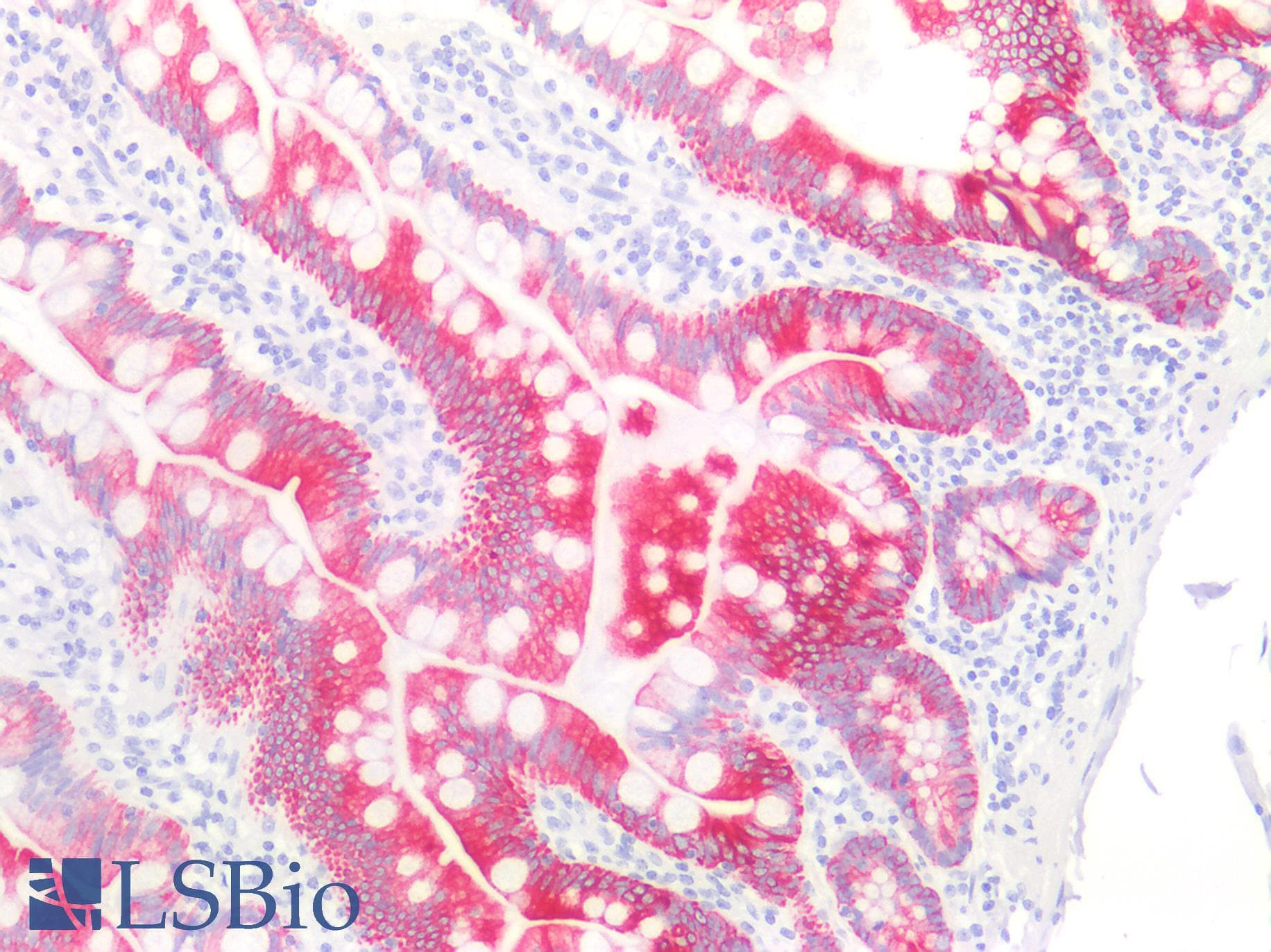 PathPlus™ KRT18 / CK18 / Cytokeratin 18 Antibody