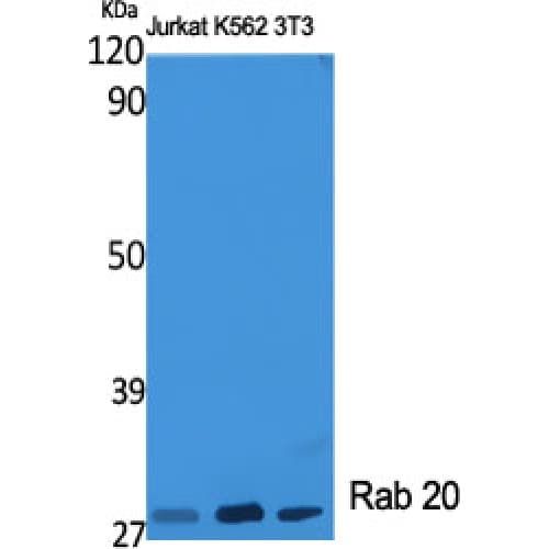 RAB20 Antibody (90-170 aa, Internal)