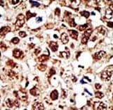 FDFT1 / Squalene Synthase Antibody (aa140-170)