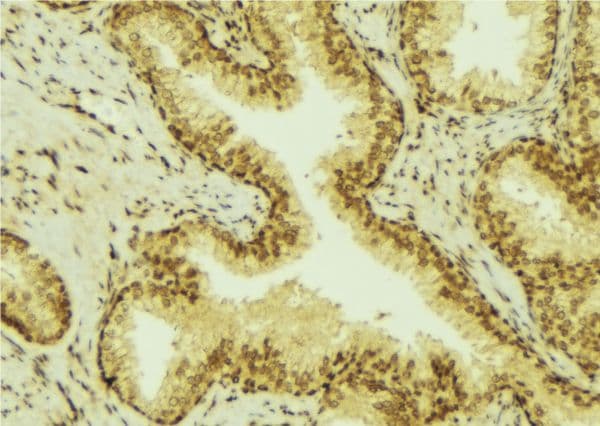 UGT1A4 Antibody