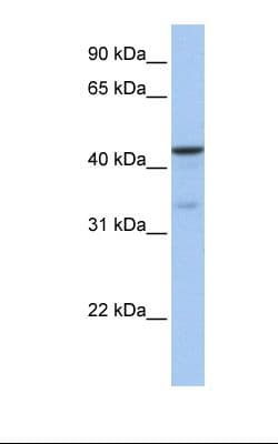 GSK3B / GSK3 Beta Antibody (aa326-375)
