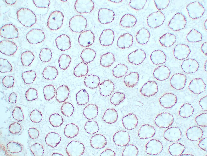 CDX2 Antibody (clone ABT-CDX2)