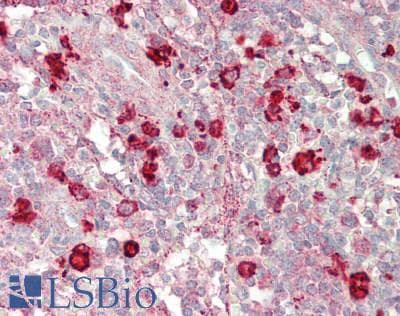 IHC-plus™ GAPVD1 Antibody (aa700-750)