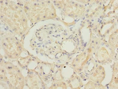 Polyclonal Rabbit anti-Human RUSC1 Antibody (IHC)