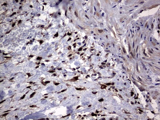 Monoclonal Mouse anti-Human PRX-1 / PRRX1 Antibody (clone OTI6A4, IHC, WB)