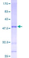 Human AIG1 Protein (Recombinant GST)