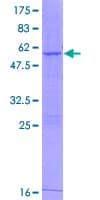 Human ACAD10 Protein (Recombinant GST)