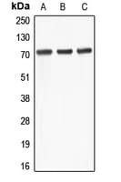Polyclonal Rabbit anti-Human ABCD4 Antibody (aa126-165, IHC, WB)