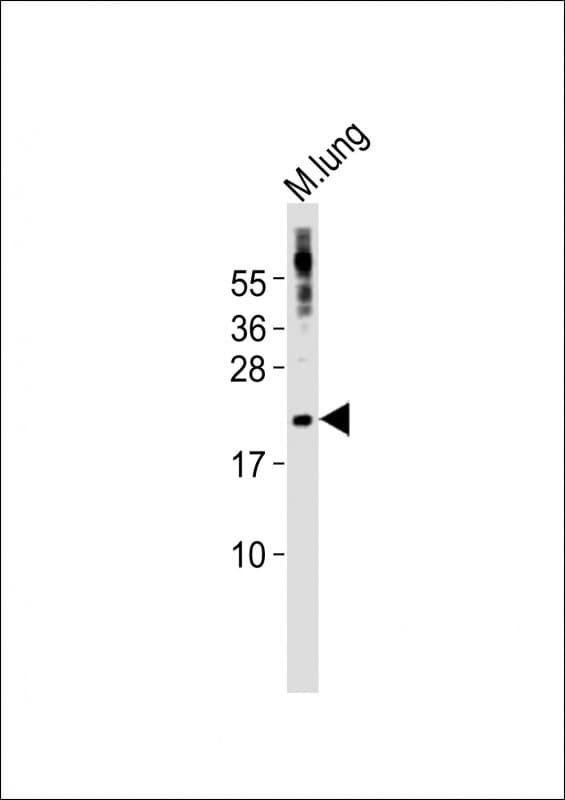 SCX Antibody (aa172-205)