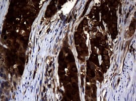 NME1 / NM23 Antibody (clone OTI2H10)