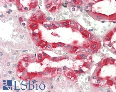 IHC-plus™ NNMT Antibody (clone 3E3)