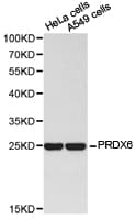 PRDX6 / Peroxiredoxin 6 Antibody