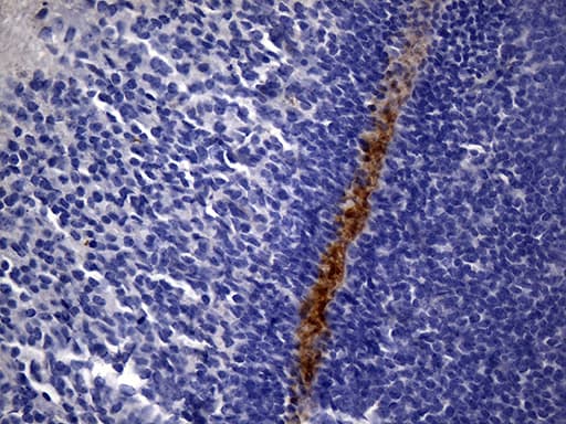 Monoclonal Mouse anti-Human MME / CD10 Antibody (clone UMAB236, Carrier-free, aa411-750, IHC, WB)