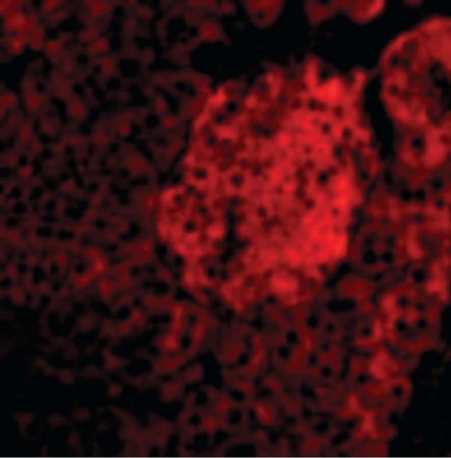 PathPlus™ IL23A / IL-23 p19 Antibody
