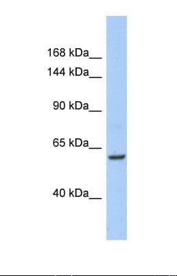 TRIO Antibody (aa106-155)