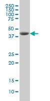 DHODH Antibody (clone 6E1)