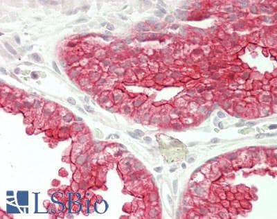 IHC-plus™ BAIAP2 / IRSP53 Antibody