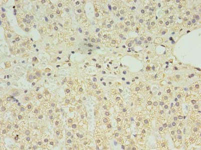 CLPB Antibody