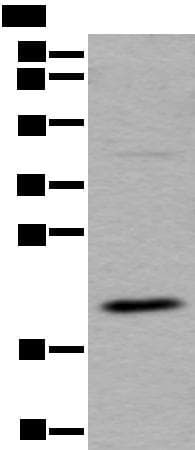 UFC1 Antibody