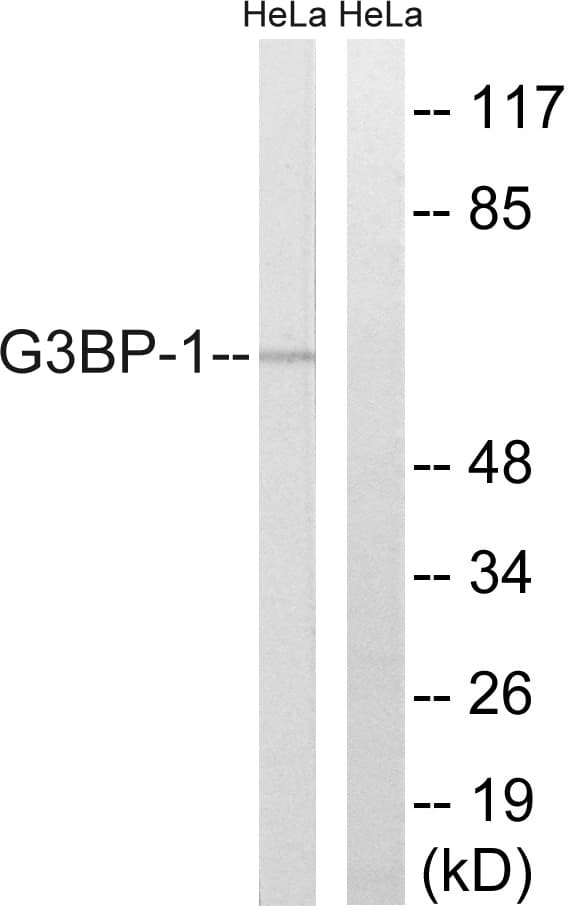 G3BP1 / G3BP Antibody (aa199-248)