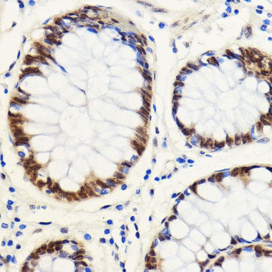 SNIP1 Antibody