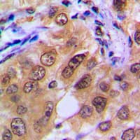 Polyclonal Rabbit anti-Human Securin / PTTG1 Antibody (Internal, IHC, IF, WB)