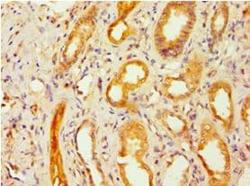 Polyclonal Rabbit anti-Human DFNA5 Antibody (aa1-260, IHC, WB)