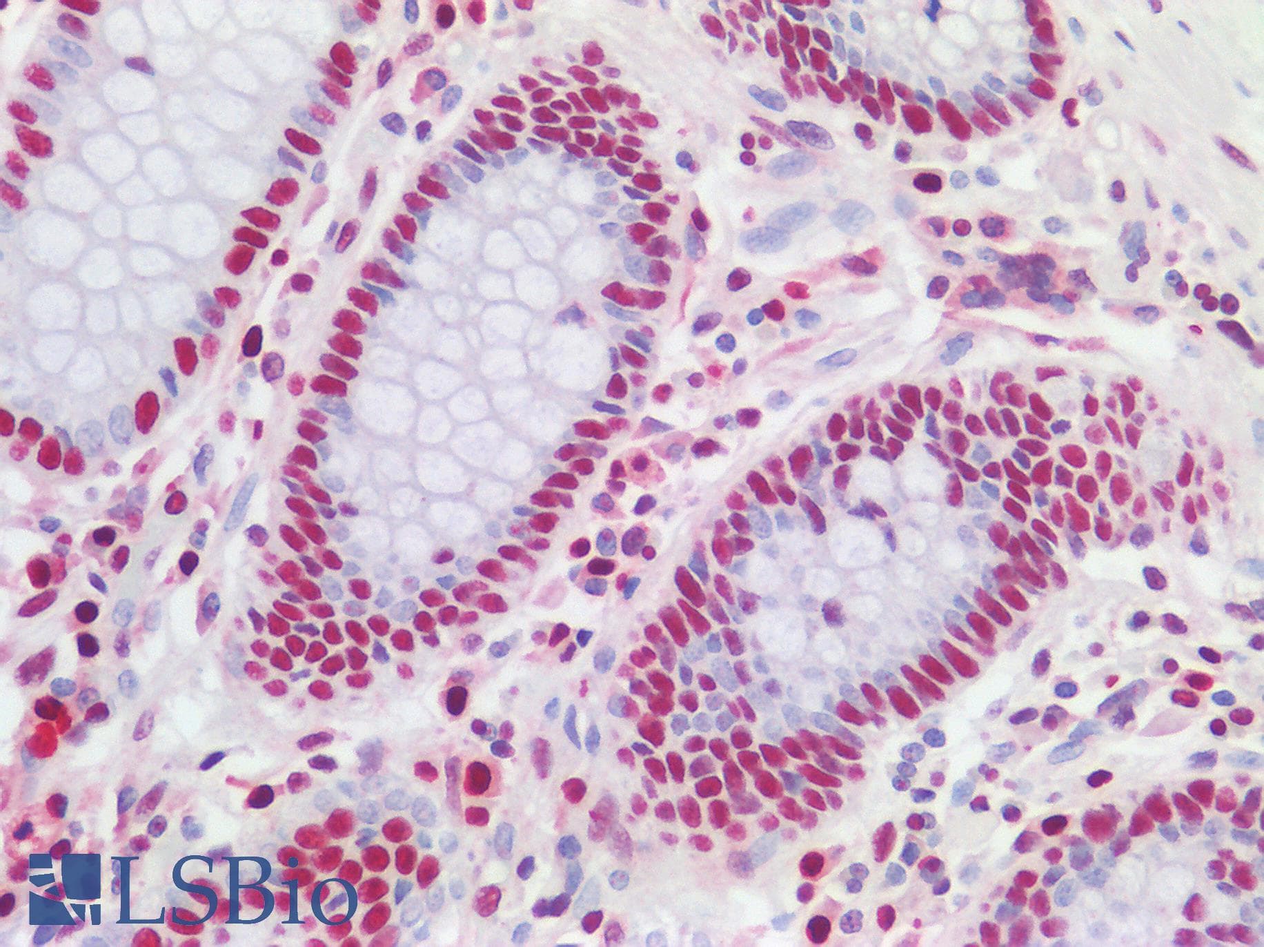 IHC-plus™ SUB1 Antibody (aa77-127)