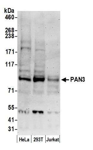 Polyclonal Rabbit anti-Human PAN3 Antibody (aa175-225, WB)