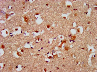 Polyclonal Rabbit anti-Human CAPS2 Antibody (IHC, WB)