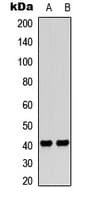 F2RL3 / PAR4 Antibody (Internal)