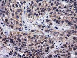 DNAJB1 / Hsp40 Antibody (clone OTI1E9)
