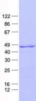 Human PDGF-D Protein (Recombinant His, N-Terminal)