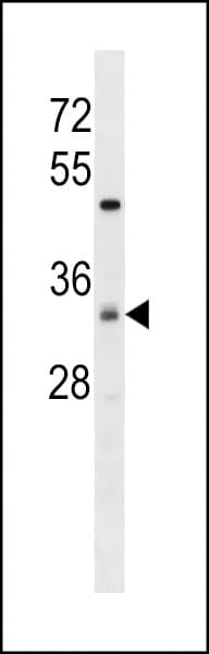 Polyclonal Rabbit anti-Human ZDHHC7 Antibody (aa240-267, WB)