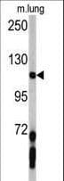 PDGFRA / PDGFR Alpha Antibody (aa1048-1077)