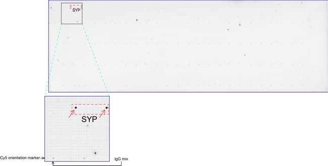 SYP / Synaptophysin Antibody (clone UMAB112)