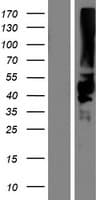 KIR2DS5 Protein (Over-Expression Lysate Myc-DDK (Flag))