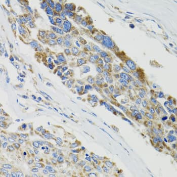 Polyclonal Rabbit anti-Human SH2B1 Antibody (IHC, IF, WB)