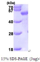 Human SQSTM1 Protein (Recombinant His)