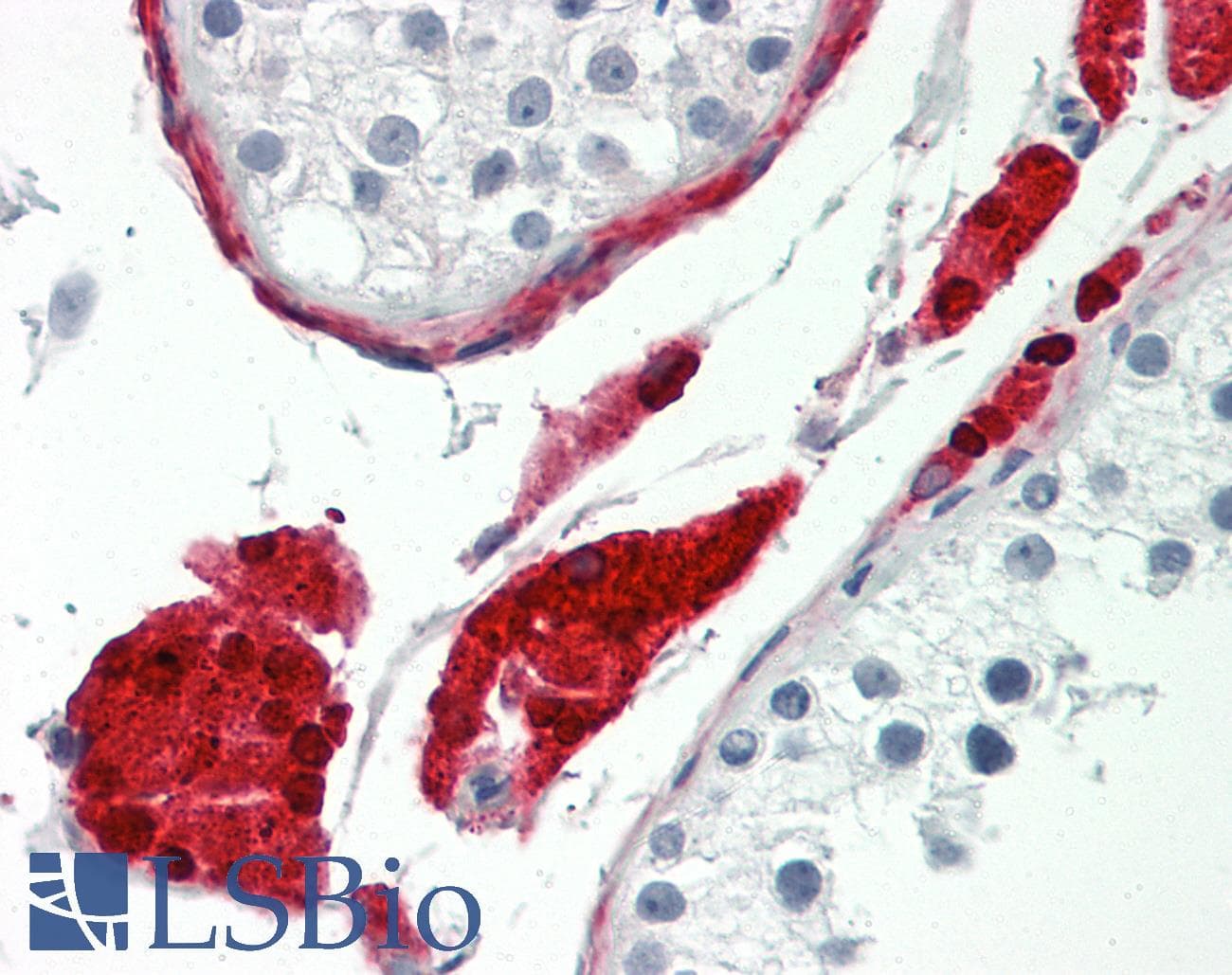 Polyclonal Rabbit anti-Human BAP / SIL1 Antibody (aa360-409, IHC, WB)