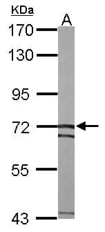 SLC25A13 / CITRIN Antibody (aa248-535)