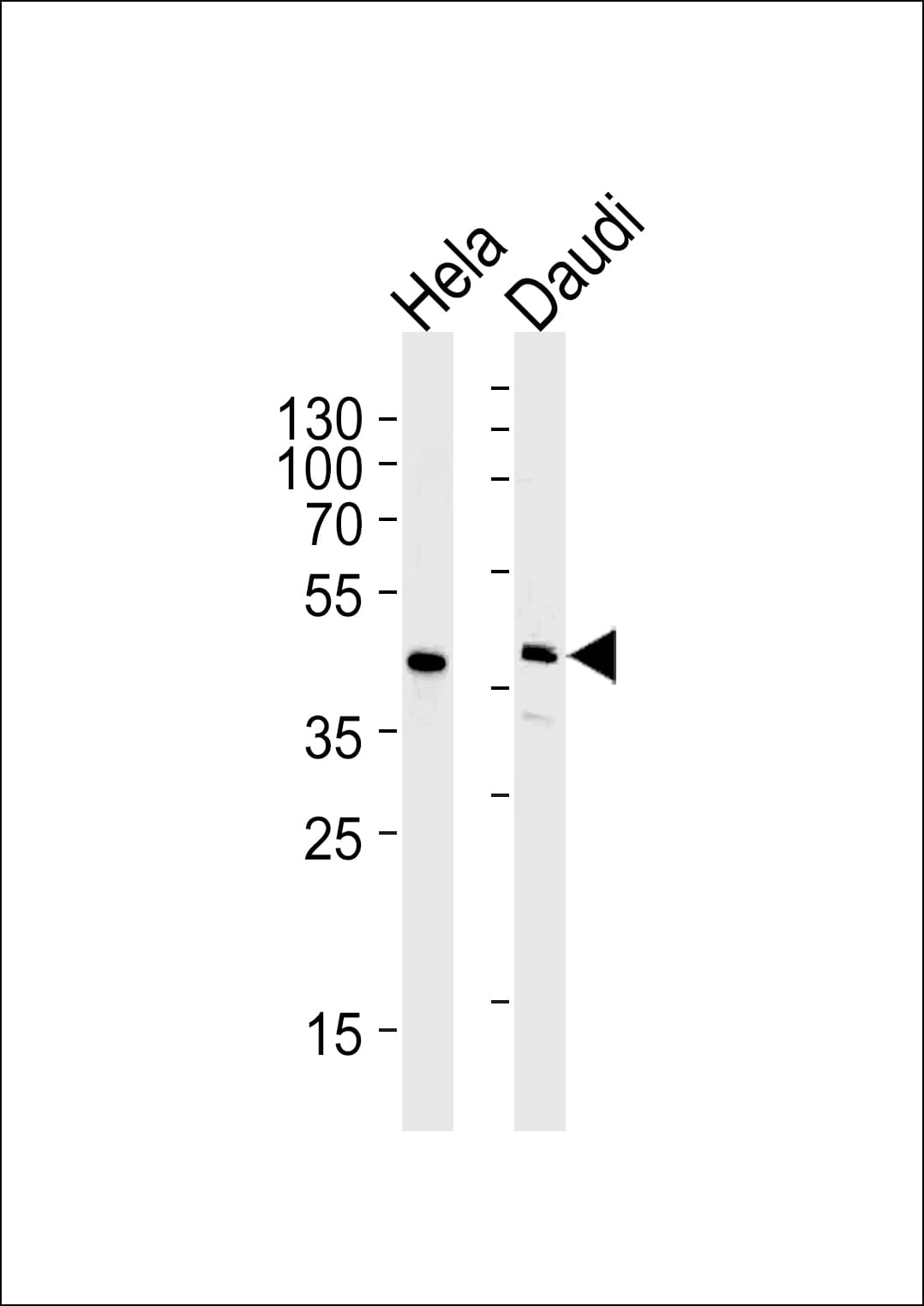 Monoclonal Mouse anti-Human USF1 / USF Antibody (clone 1264CT170.274.14, aa1-310, WB)