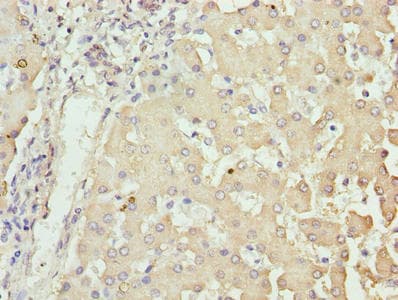 NUPL2 Antibody