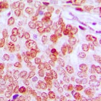 ATF5 Antibody (C-Terminus)