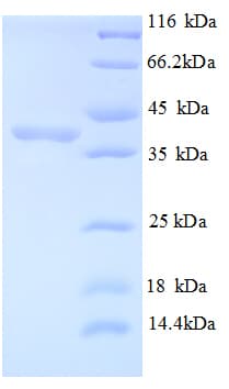 Human MIB1 Protein (Recombinant His)